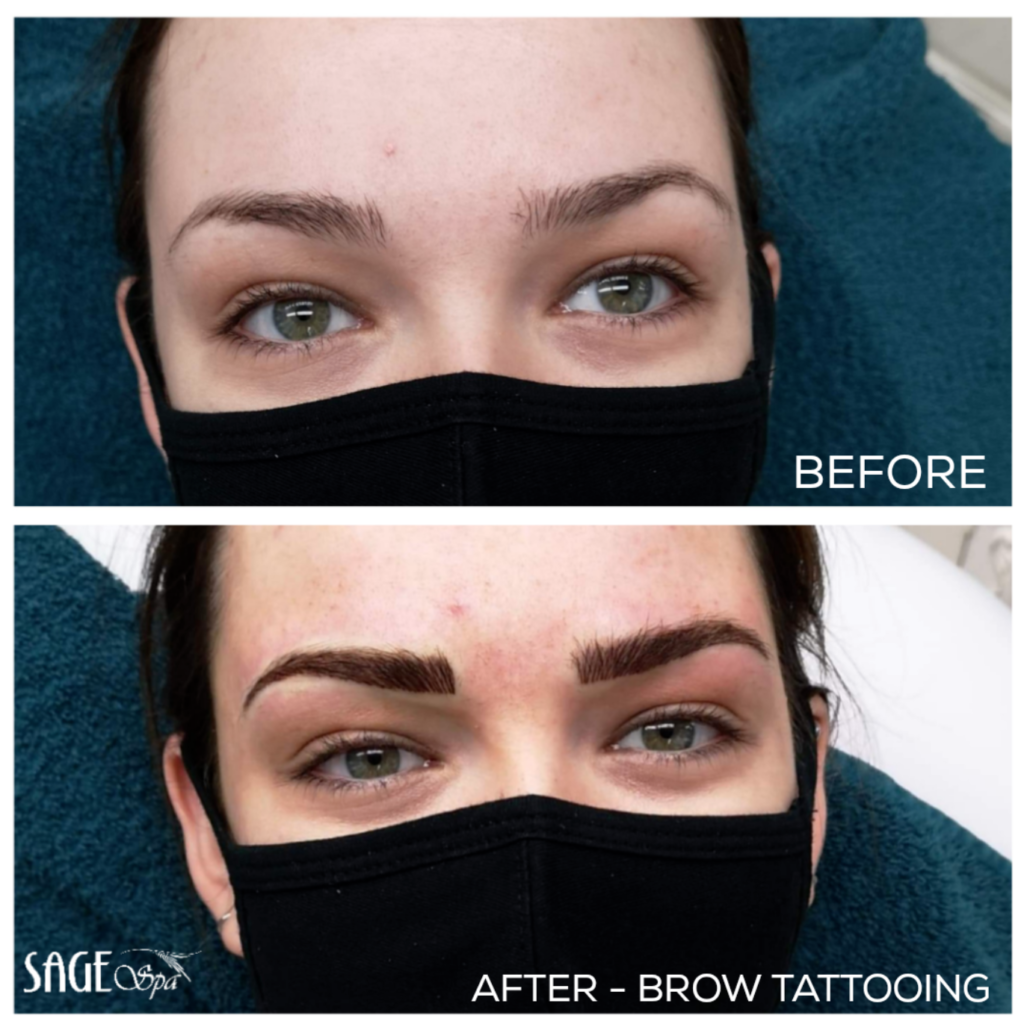 Cosmetic Tattooing